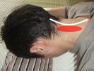 頚後ろの痛み