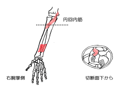 円回内筋