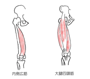 内側広筋