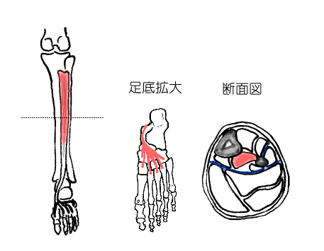 後脛骨筋