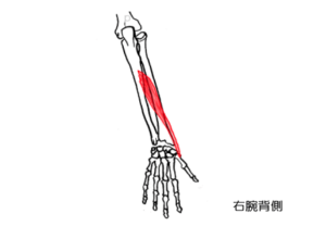 長母指外転筋