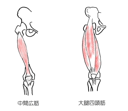 中間広筋