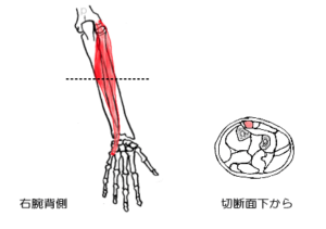 尺側手根伸筋