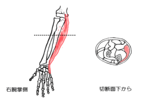 尺側手根屈筋