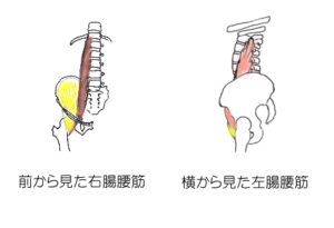 腸腰筋