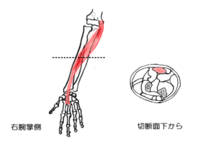 撓側手根屈筋