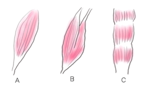 筋腹の違いによる筋肉の分類