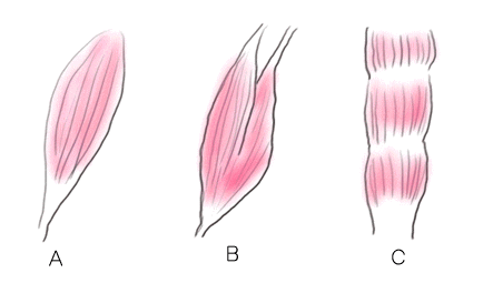 筋腹の違いによる分類